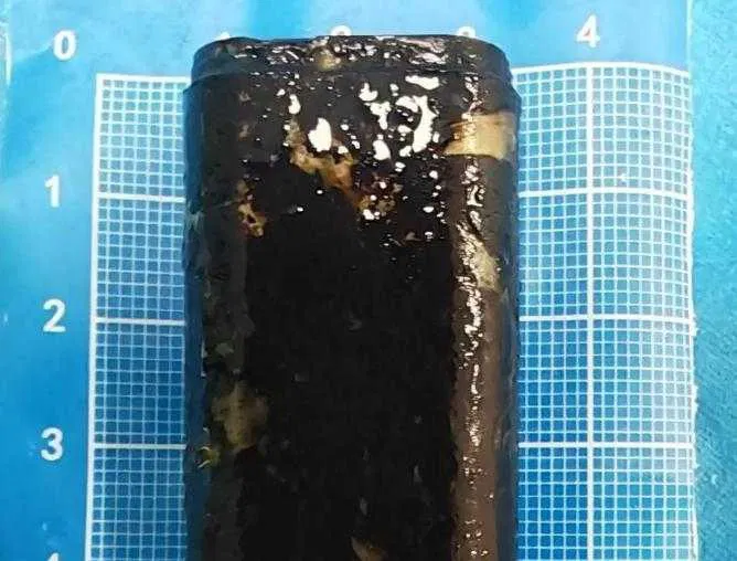 صيني يعيش مع ولاعة سجائر وظيفية في معدته لمدة 30 عاماً صيني يعيش مع ولاعة سجائر وظيفية في معدته لمدة 30 عاماً