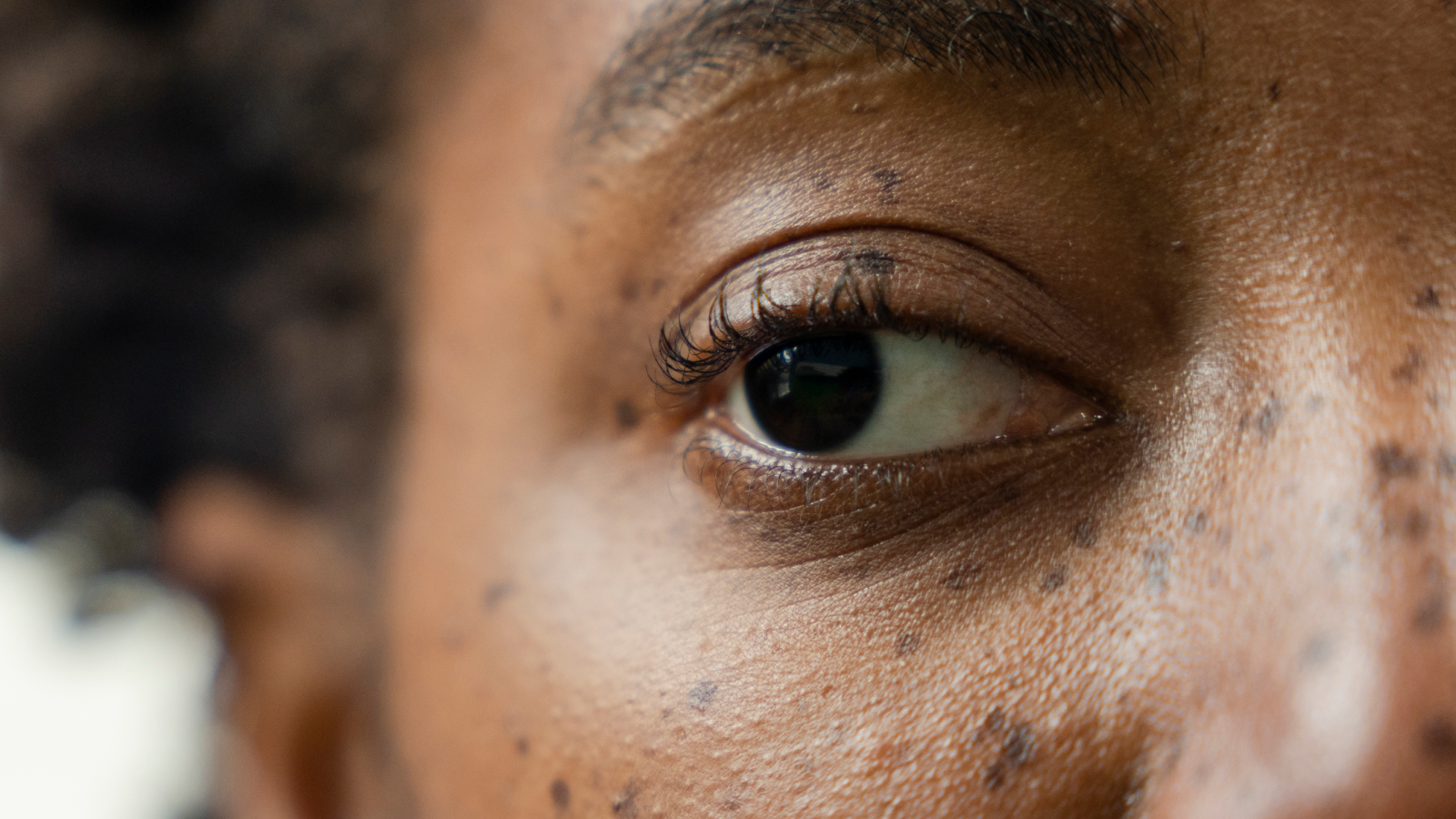 حقن المخدر في العين الكسولة قد يساهم في تصحيحها، وفقًا لدراسة أولية جديدة حقن المخدر في "العين الكسولة" قد يساهم في تصحيحها، وفقًا لدراسة أولية جديدة