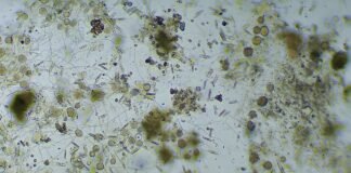 استخدام Aged Bacteria لتعزيز اعتمادية عمليات Bio
