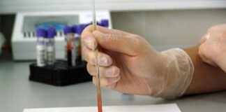 صورة يد بسيطة قد تساهم في كشف مرض خطير عبر تقنيات علمية
